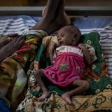 Unicef upozorava da bi 30.000 dece moglo da umre od gladi u Etiopiji 1