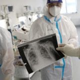 „Sumnjivi“ brojni slučajevi bolesti sistema za disanje 1