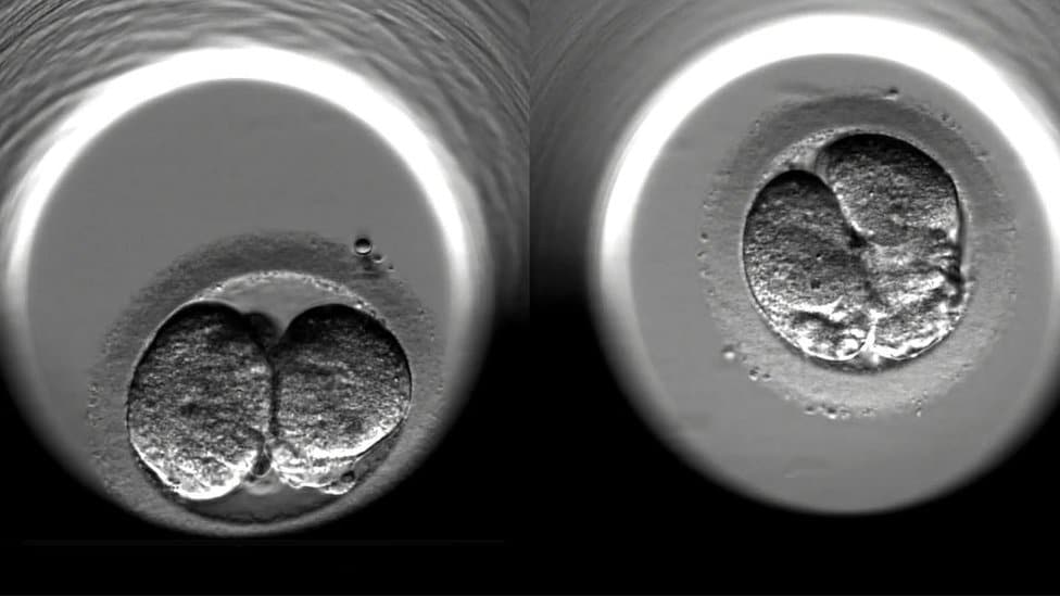 The cell-division of two fertilised human embryos during the first 24 hours of embryonic development following IVF treatment