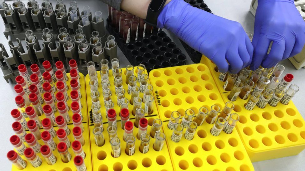 Životinje: Vantelesna oplodnja, surogat majčinstvo i ćelije kože - kako naučnici pokušavaju da spasu severnog belog nosoroga od izumiranja 6 A female scientist andling samples at an in vitro general clinical research laboratory.