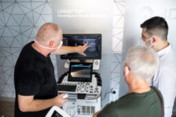 Broj mamografskih pregleda u nekim zemljama Evrope opao za 90 odsto tokom pandemije 6