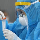 U BiH skoro hiljadu novozaraženih, preminule 32 osobe 6