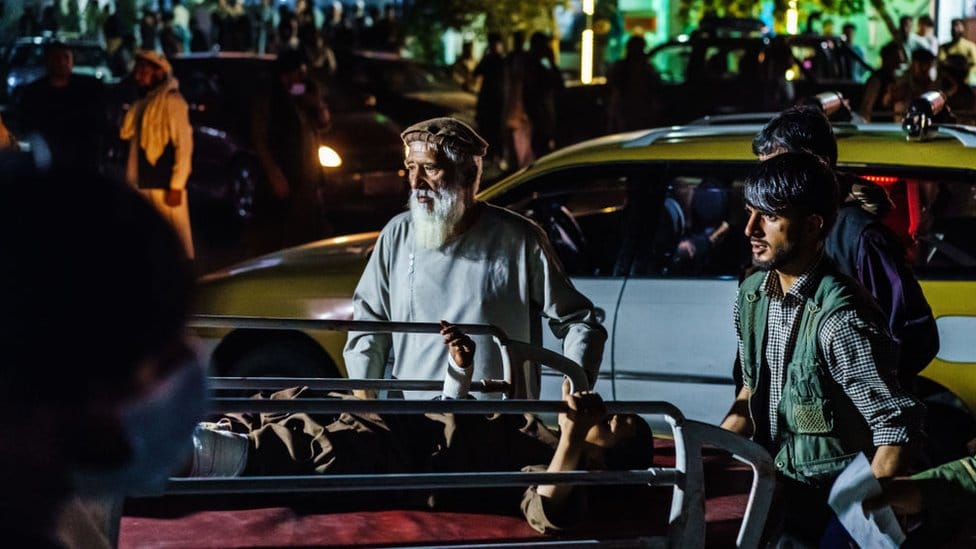 Avganistan: U napadu bombaša-samoubice poginulo 170 ljudi, Pentagon upozorava na nove dok se evakuacija bliži kraju 1 A wounded patient is brought by a taxi to the Emergency hospital in Kabul