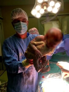 Ginekolog: Na pola operacije nam saopštavali da bolnicu treba hitno izprazniti jer prelazimo u "kovid režim" (VIDEO) 2