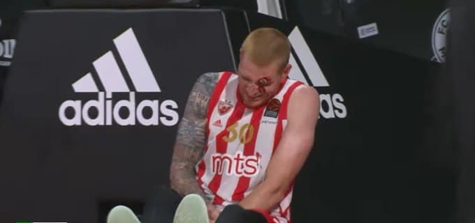 Eron Vajt u nedelju na operaciji, oporavak šest nedelja 1