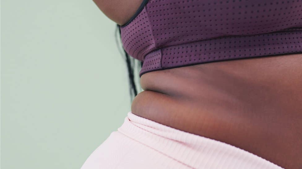 A black woman with fat folds