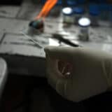 Broj umrlih od tuberkuloze prvi put raste u poslednjih deset godina 11