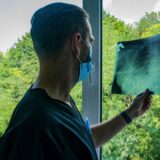 Nauka i iks zraci: Šta je rendgen i zašto medicina ne može bez njega 10