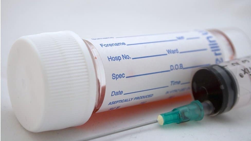 Korona virus, Srbija i zeleni sertifikat: Kako mogu da se testiram na antitela i da li je to potrebno 2 igla i test