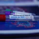 U ambulante stiglo 8 000 kombinovanih testova za utvrđivanje respiratornih infekcija dece uzrasta do 14 godina 7