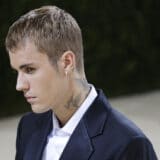 Džastin Biber otkazao koncerte zbog paralize dela lica 4