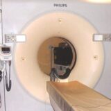 Ranim skriningom protiv poražavajuće statistike 11