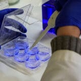 Južna Koreja potvrdila prvi slučaj zaražavanja parazitom "koji jede mozak" 3