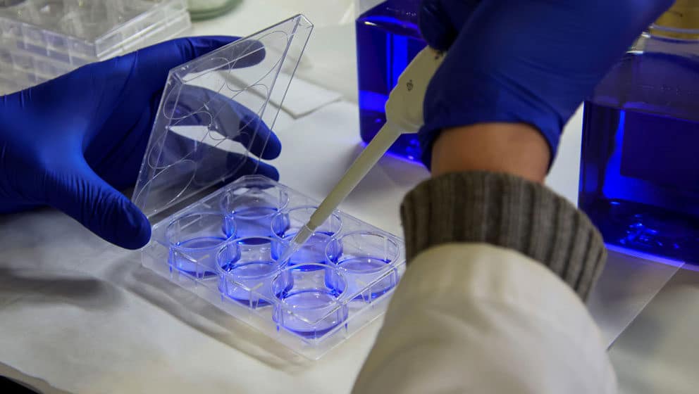 Južna Koreja potvrdila prvi slučaj zaražavanja parazitom "koji jede mozak" 1