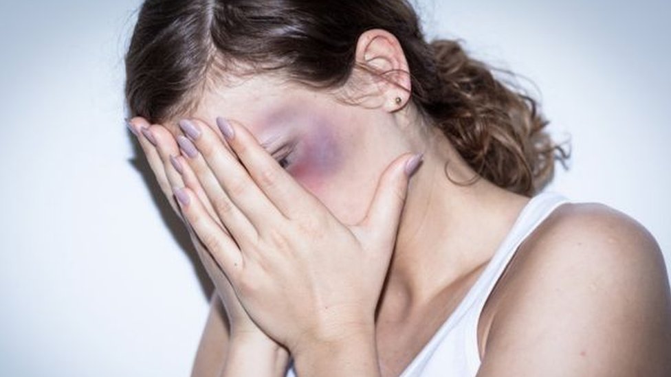 Femicid u Srbiji: Kako je moj otac ubio moju majku 2 Žena pokriva lice rukama