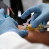 Zdravlje: Život sa HIV-om u Srbiji u doba korone - komplikacija komplikovane situacije 5