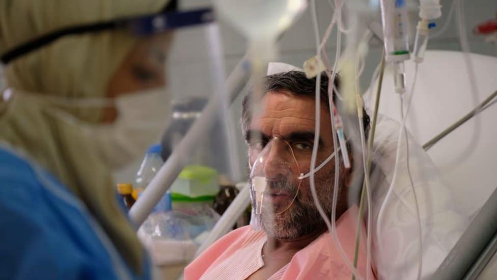 Korona virus i nauka: Odakle potiče omikron soj i kako je nastao 3 A Covid patient in Iran