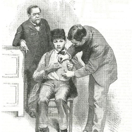 Korona virus i vakcina: Kako su antivakcinaši vršili uticaj na svet kroz istoriju 23 Louis Pasteur leaning on a cabinet while his male assistant injects a young man's stomach