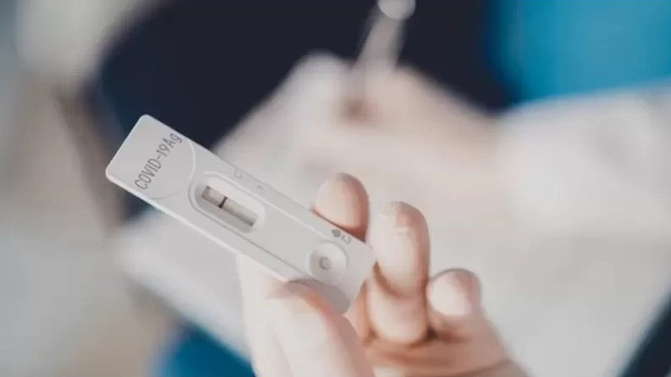 Korona virus i omikron soj: Koliko je dugo zarazan neko sa kovidom 7 An antigen, or lateral flow, test