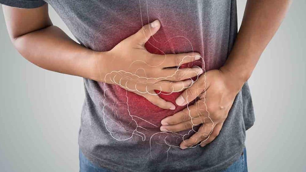 Cos’è il morbo di Crohn e come può essere curato?  – Salute