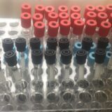 Mesec podizanja svesti o karcinomu jetre: Važno je da se makar jednom testiramo na hepatitis 4