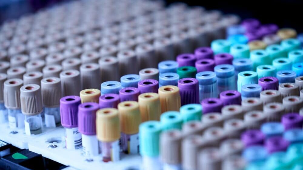U najvećoj kovid laboratoriji u Evropi moguća analiza 800.000 PCR testova dnevno 1