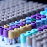 U najvećoj kovid laboratoriji u Evropi moguća analiza 800.000 PCR testova dnevno 3