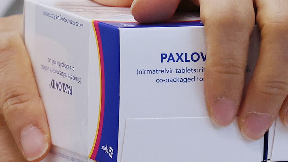 Testiranje Pakslovid-a pri lečenju dugotrajnih posledica kovida daje dobre rezultate 1