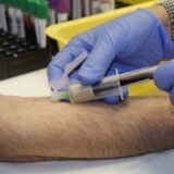 NURDOR pozvao Subotičane da doniraju krv povodom Svetskog dana dece obolele od raka 6