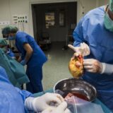 transplantacija srca