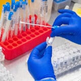 Koliko su nemačke laboratorije zaradile na PCR testovima? 10