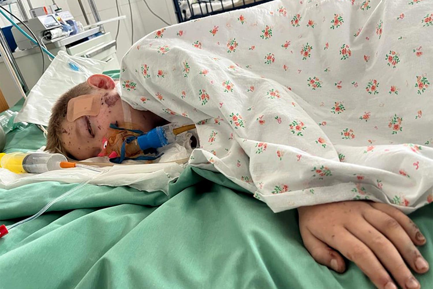 Rusija i Ukrajina: „Ako padne Harkov, pašće i cela Ukrajina" 5 Dimitri in intensive care