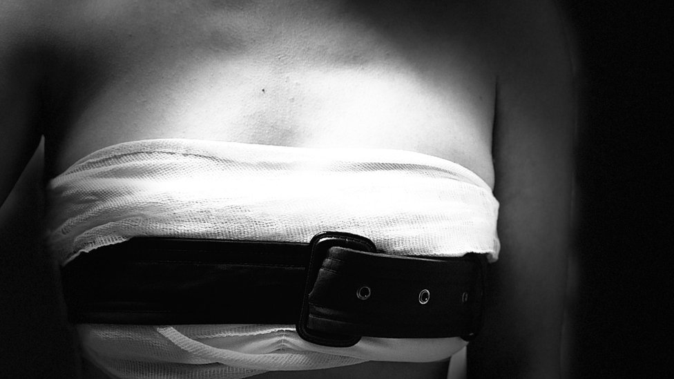 Srbija i LGBT prava: Život roditelja trans dece - „To nije izbor, to je ono što on jeste“ 4 Stezanje grudi može biti signal da je detetu potrebna pomoć