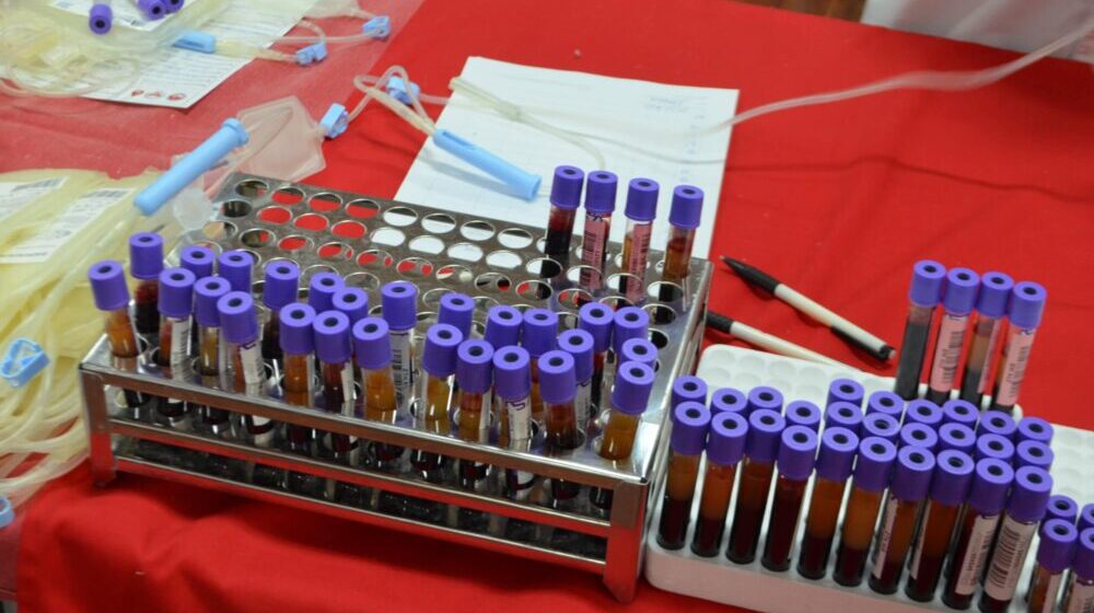Novi Pazar: Za dva dana prikupljeno 100 jedinica krvi 15