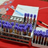 Novi Pazar: Za dva dana prikupljeno 100 jedinica krvi 12
