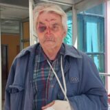 Prelom šake, jagodične kosti, nosa i povreda oka, epilog su napada pasa na Zaječarca: Lekari su morali i da ušiju rane 4