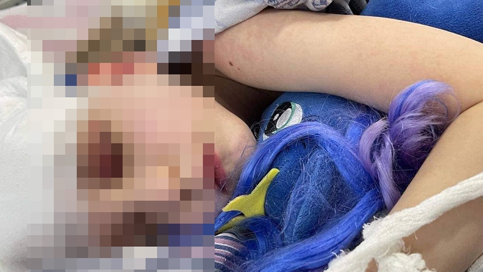 Katя i poni. Foto iz bolьnicы