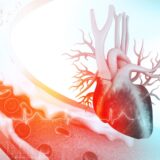 Najvažnije informacije o aterosklerozi koje treba da znate 9