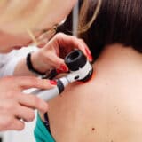 Za poljoprivrednike besplatni pregledi kože na četiri mesta u Vojvodini 5