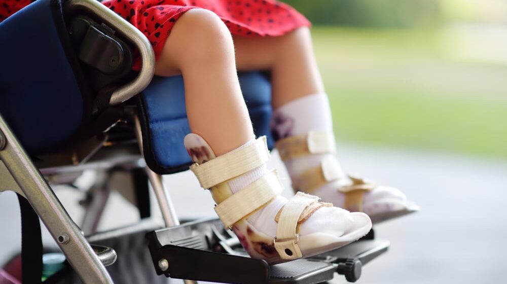 Obeleženo 65 godina rada Saveza za cerebralnu i dečiju paralizu Beograda 1