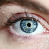 Tri promene na očima koje ukazuju na višak holesterola u organizmu 13