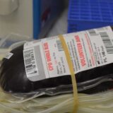 Institut za transfuziju: Zalihe krvi dovoljne za jedan dan 10
