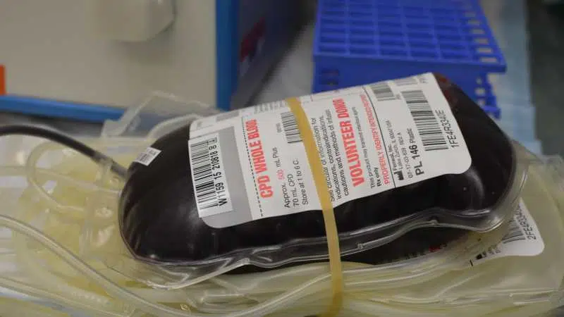 Institut za transfuziju: Zalihe krvi dovoljne za jedan dan 1