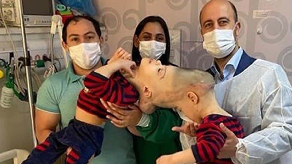Bernardo and Arthur Lima with parents and surgeon