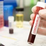 Nemačka sprema nove mere za treću jesen pandemije 4