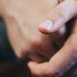 Na koje bolesti mogu ukazivati žuti nokti? 3