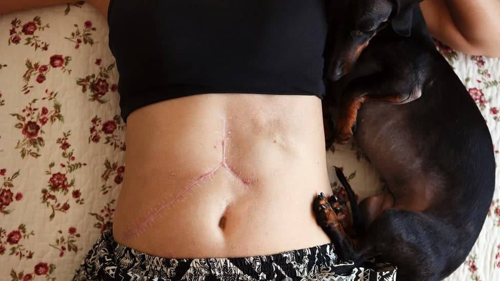 Životinje i medicina: Kako miš može da pomogne ljudima da se oporave od teških povreda 3 životinje i rane