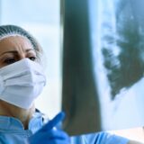 Zdravlje i bolesti: Istraga u Argentini zbog misterioznih smrti od posledica upale pluća 6