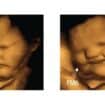 Nauka: Nerođene bebe se „smeškaju” šargarepi i „mršte” kelju, pokazalo je istraživanje 16