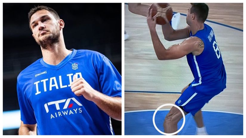 Danilo Galinari ipak teže povređen; sjajni Italijan pokidao prednji ukršteni ligament 1
